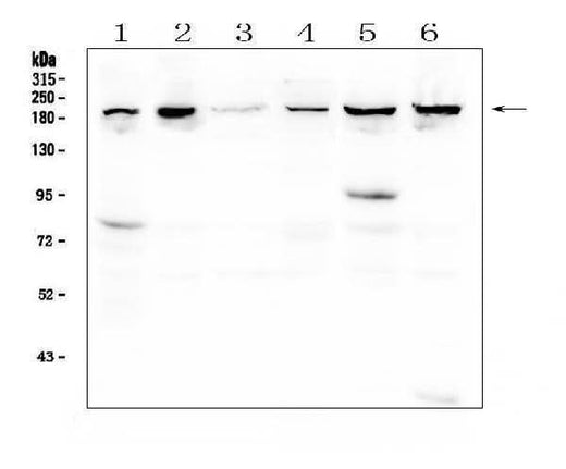 Anti-CPAMD8 Antibody Picoband® Boster Bio