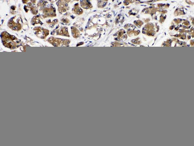 Anti-Amylase/AMY1A/AMY1B/AMY1C Antibody Picoband® Boster Bio