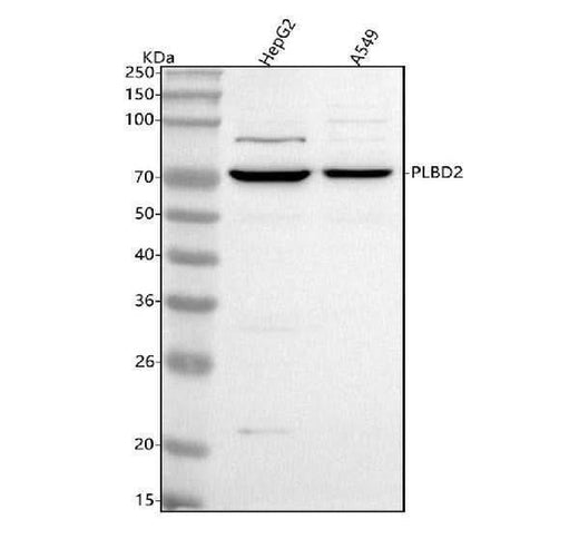 Anti-PLBD2 Antibody Picoband® Boster Bio