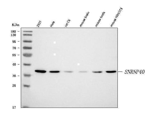 Anti-SNRNP40 Antibody Picoband® Boster Bio