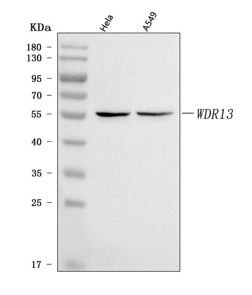 Anti-WDR13 Antibody Picoband® Boster Bio