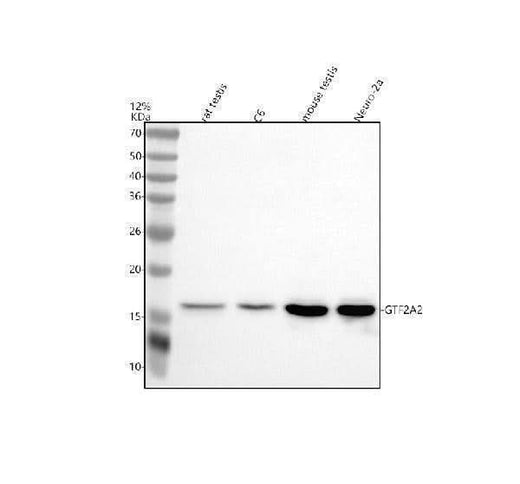 Anti-GTF2A2 Antibody Picoband® Boster Bio