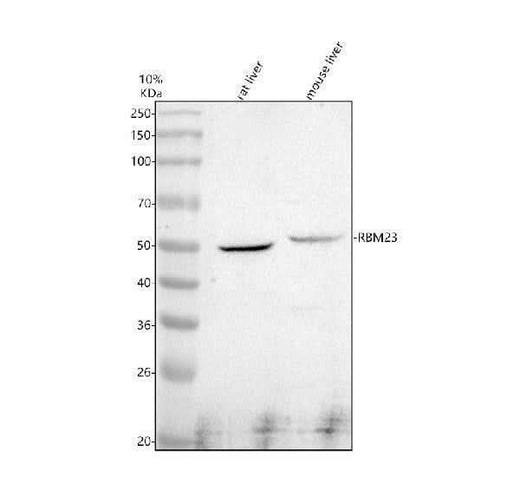 Anti-RBM23 Antibody Picoband® Boster Bio