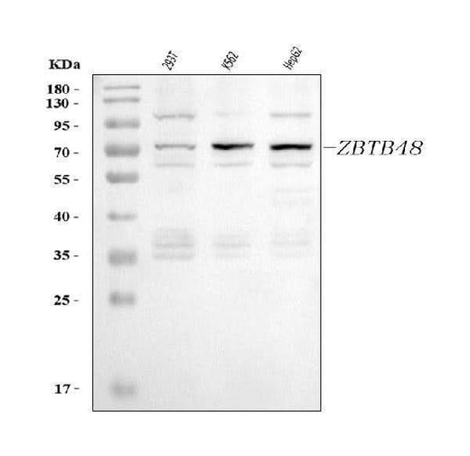 Anti-ZBTB48 Antibody Picoband® Boster Bio