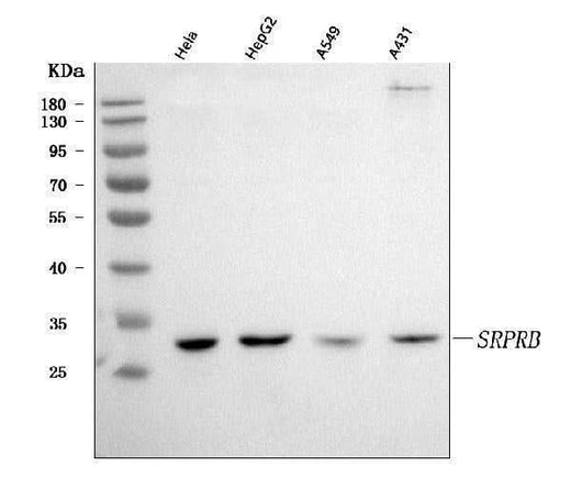 Anti-SRPRB Antibody Picoband® Boster Bio