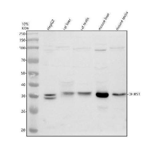 Anti-DHRS1 Antibody Picoband® Boster Bio