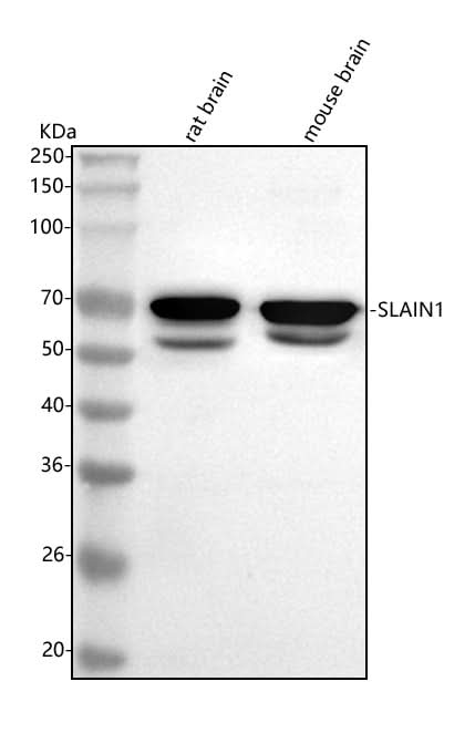 Anti-SLAIN1 Antibody Picoband® Boster Bio