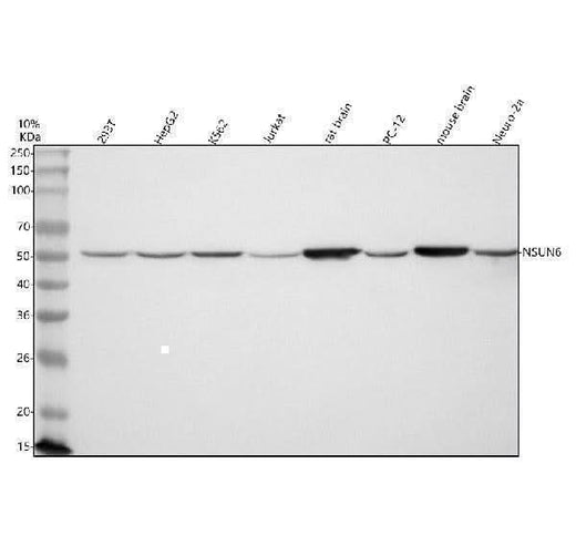 Anti-NSUN6 Antibody Picoband® Boster Bio