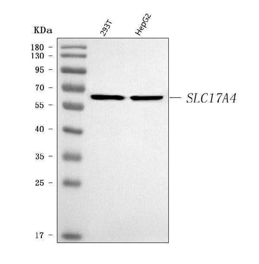 Anti-SLC17A4 Antibody Picoband® Boster Bio