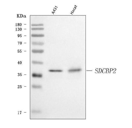Anti-Syntenin 2/SDCBP2 Antibody Picoband® Boster Bio