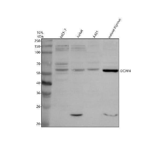 Anti-WDR21A/DCAF4 Antibody Picoband® Boster Bio
