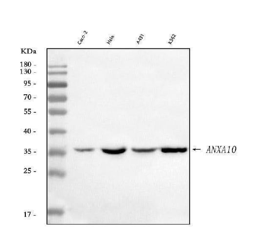 Anti-Annexin A10/ANXA10 Antibody Picoband® Boster Bio