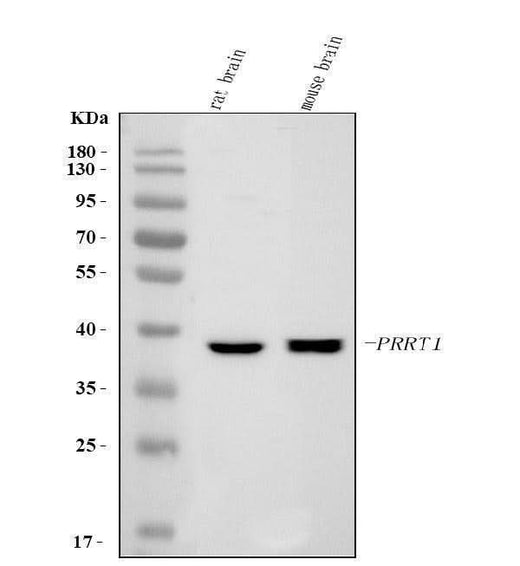 Anti-SynDIG4/PRRT1 Antibody Picoband® Boster Bio