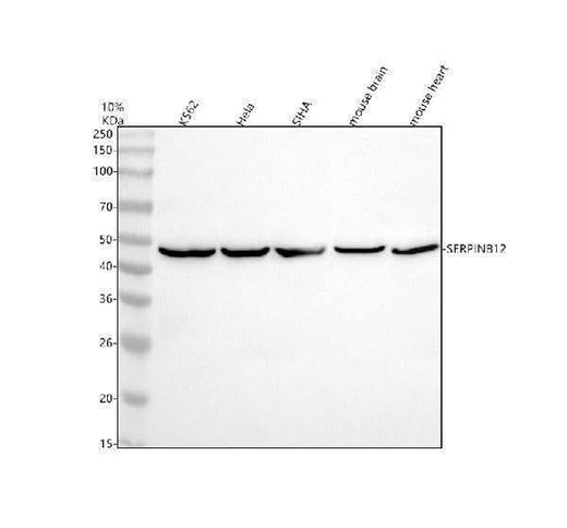 Anti-SERPINB12 Antibody Picoband® Boster Bio