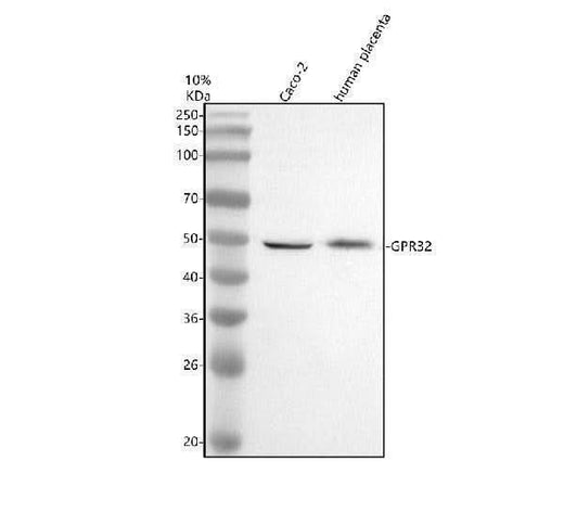 Anti-GPR32 Antibody Picoband® Boster Bio