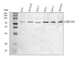 Anti-LRCH4 Antibody Picoband® Boster Bio