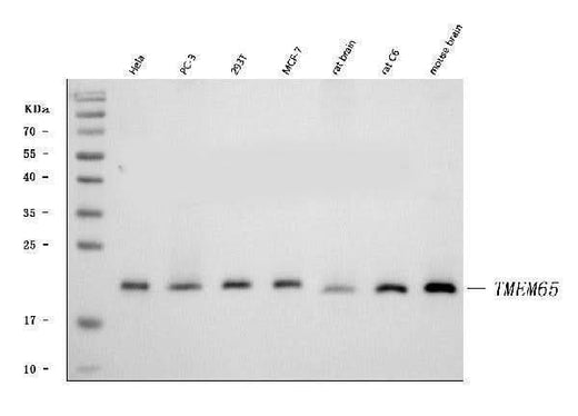 Anti-TMEM65 Antibody Picoband® Boster Bio