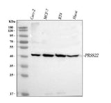 Anti-PRSS22 Antibody Picoband® Boster Bio