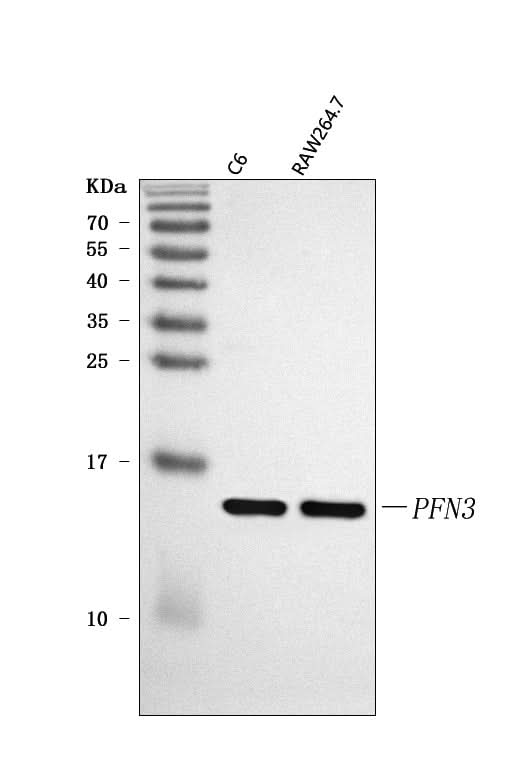 Anti-PFN3 Antibody Picoband® Boster Bio