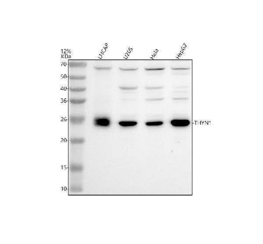 Anti-THYN1 Antibody Picoband® Boster Bio