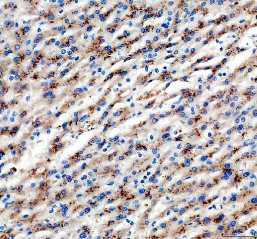 Anti-SLC25A47 Antibody Boster Bio