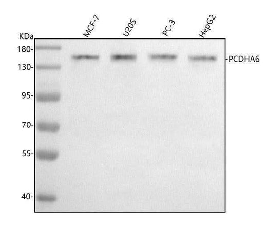 Anti-PCDHA6 Antibody Picoband® Boster Bio
