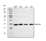 Anti-MRPS25 Antibody Picoband® Boster Bio