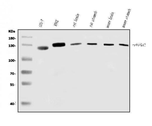 Anti-PPP4R1 Antibody Picoband® Boster Bio