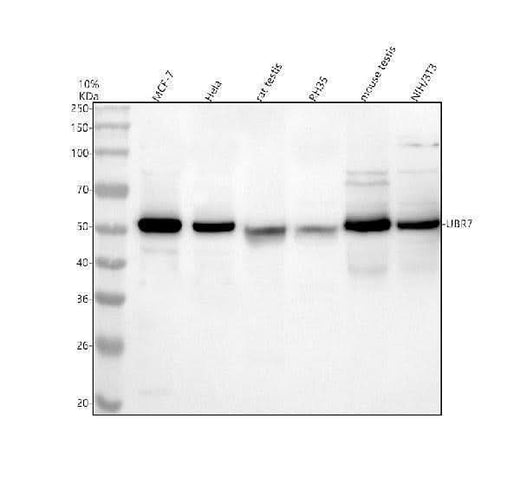 Anti-UBR7 Antibody Picoband® Boster Bio