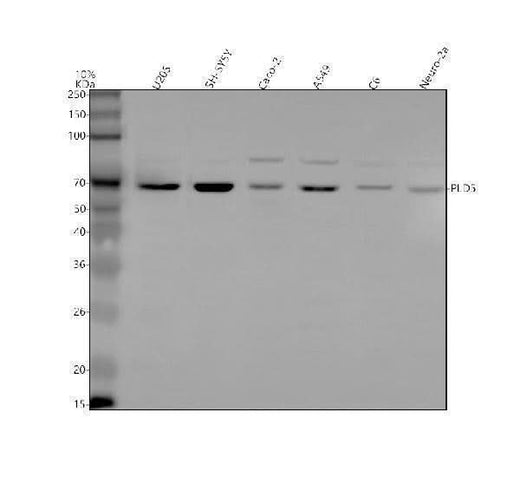 Anti-PLD5 Antibody Picoband® Boster Bio