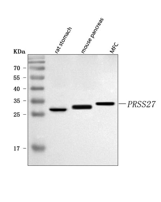 Anti-PRSS27 Antibody Picoband® Boster Bio