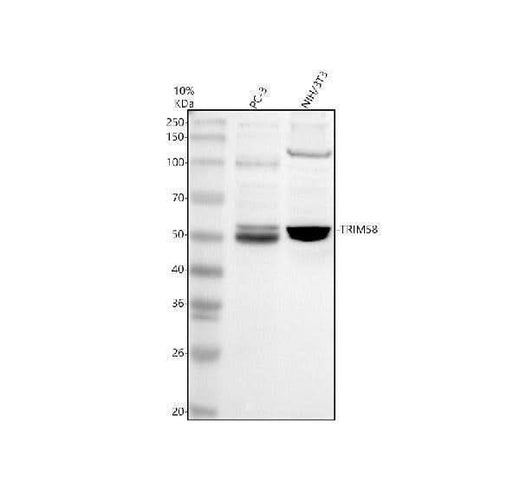 Anti-TRIM58 Antibody Picoband® Boster Bio