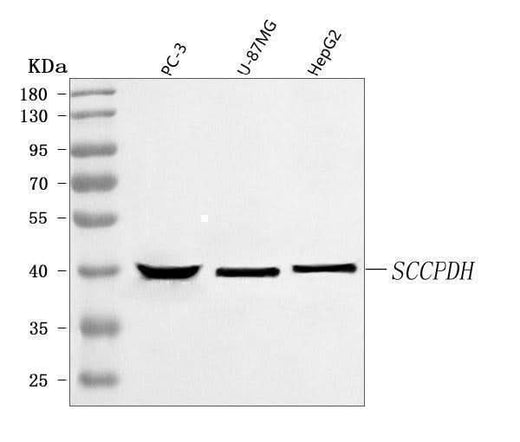Anti-SCCPDH Antibody Picoband® Boster Bio