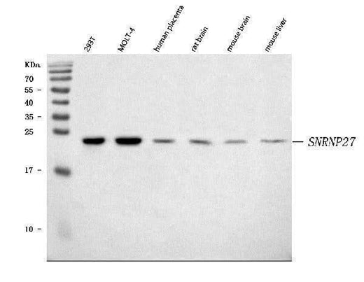 Anti-SNRNP27 Antibody Picoband® Boster Bio