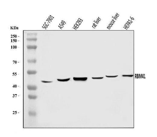 Anti-RBM41 Antibody Picoband® Boster Bio