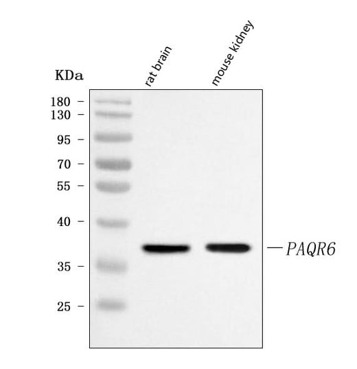 Anti-PAQR6 Antibody Picoband® Boster Bio