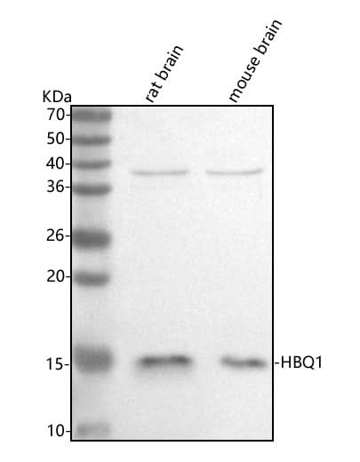 Anti-HBQ1 Antibody Picoband® Boster Bio