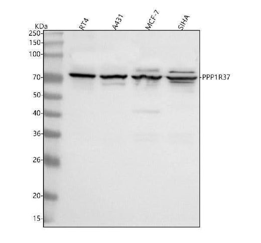 Anti-PPP1R37 Antibody Picoband® Boster Bio