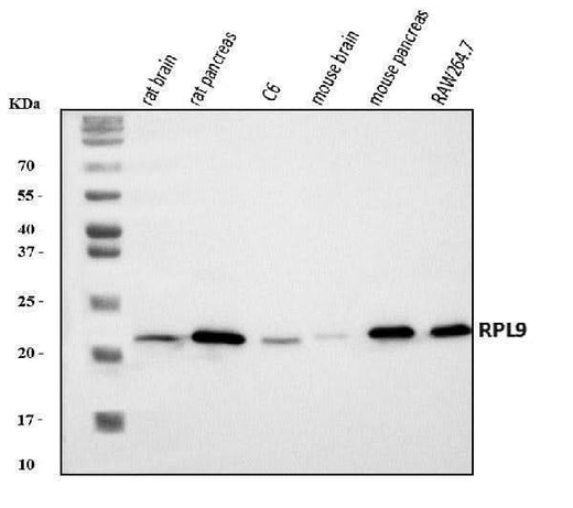 Anti-Rpl9 Antibody Picoband® Boster Bio