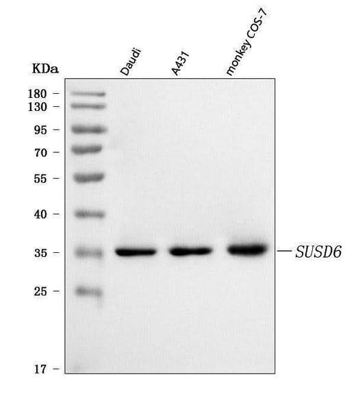 Anti-SUSD6 Antibody Picoband® Boster Bio