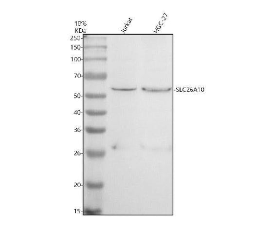 Anti-SLC26A10P Antibody Picoband® Boster Bio