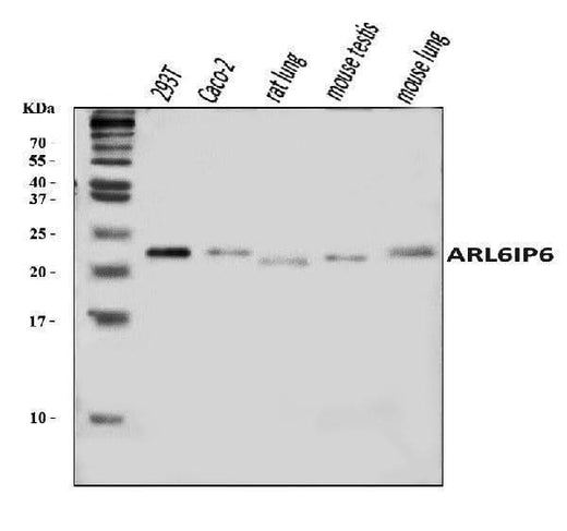 Anti-ARL6IP6 Antibody Picoband® Boster Bio
