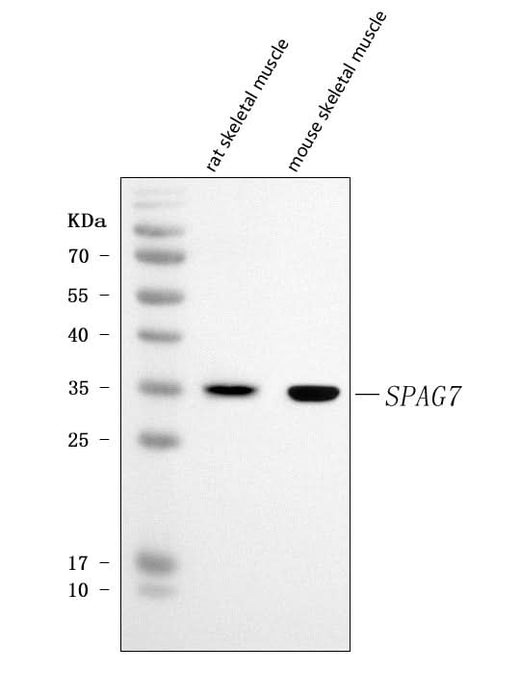 Anti-SPAG7 Antibody Picoband® Boster Bio