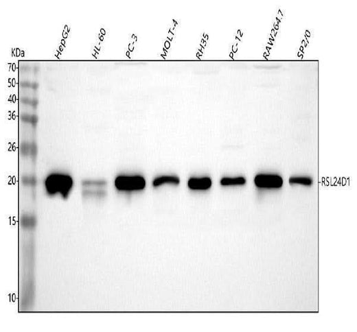 Anti-RSL24D1 Antibody Picoband® Boster Bio