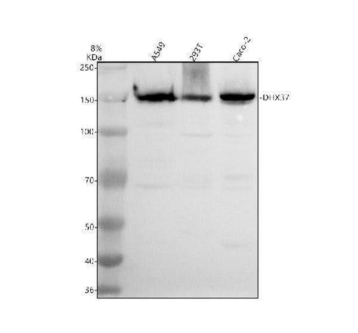 Anti-DHX37 Antibody Picoband® Boster Bio