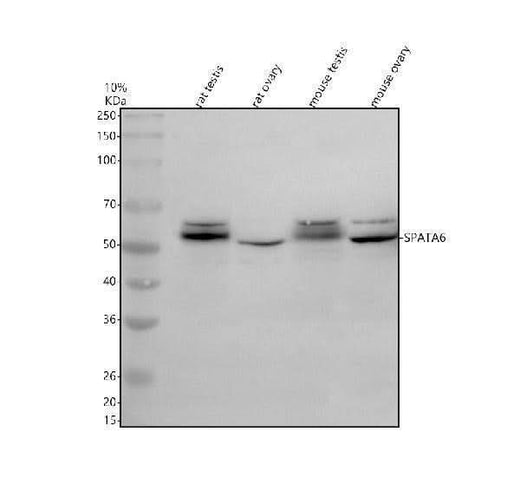 Anti-SPATA6 Antibody Picoband® Boster Bio