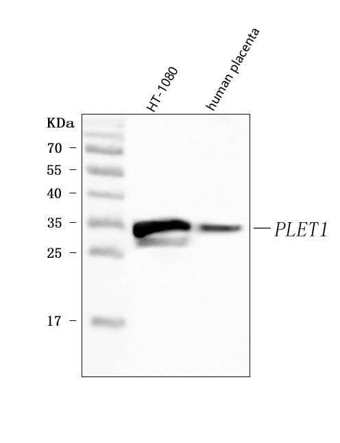 Anti-PLET1 Antibody Picoband® Boster Bio