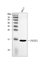 Anti-PATE1 Antibody Picoband® Boster Bio
