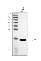 Anti-PATE1 Antibody Picoband® Boster Bio