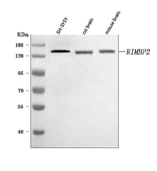 Anti-RIMBP2 Antibody Picoband® Boster Bio